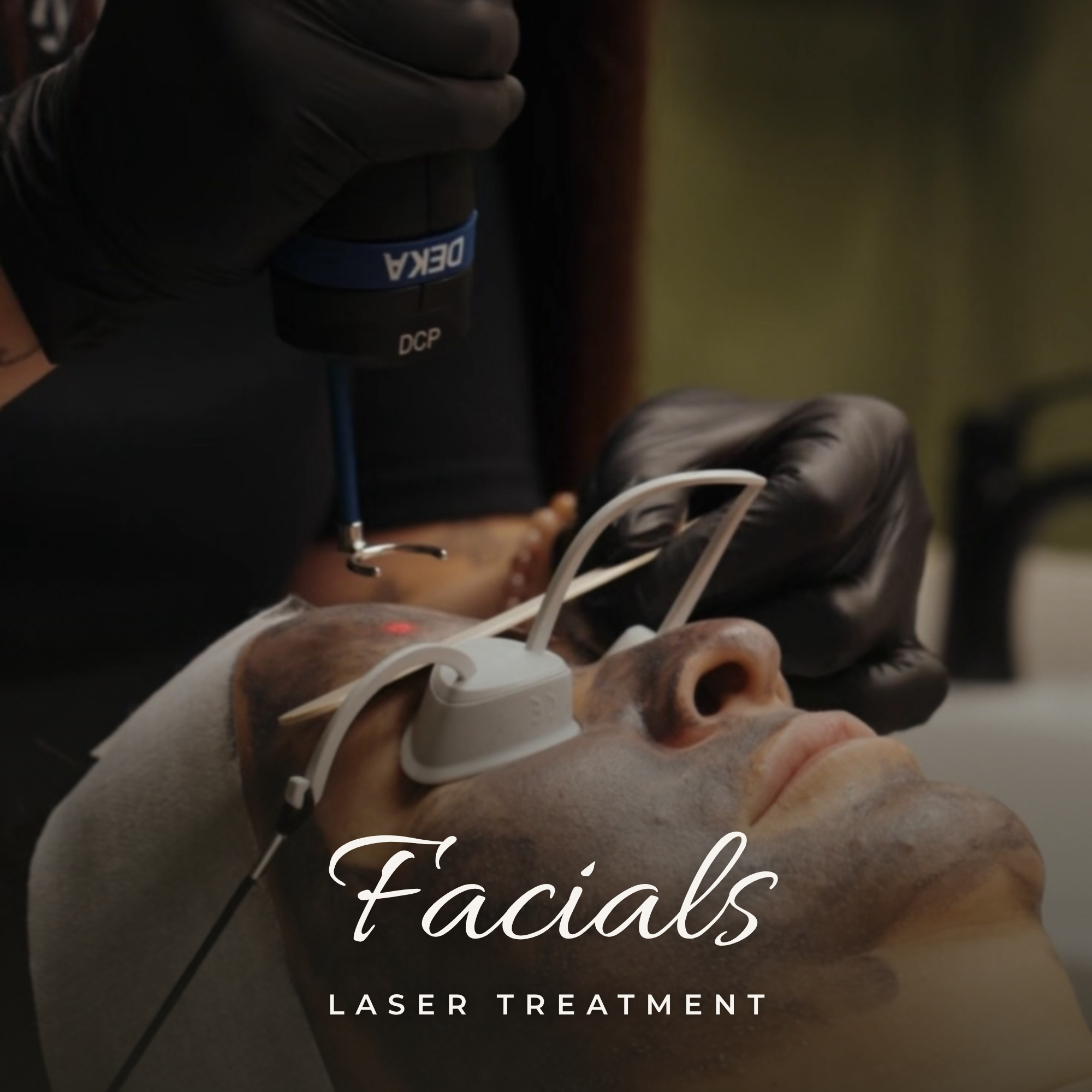 Pico Laser Facial — Consultation